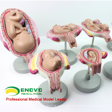 SELL 12450 Classic Schwangerschaft 8-Modell Series Set, Anatomie weibliche Schwangerschaftsmodelle